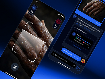 asklepios v2: AI Health & Wellness App - Symptom Checker Scan ai health assistant ai health companion ai healthcare app blue clean dark mode digital health app health assistant health companion health tracker app healthcare app healthcare ui kit image recognition minimal mobile app modern smart assistant symptom chceker virtual care wellness app