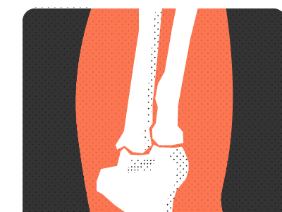 Elbow x-ray elbow infographic x ray xray