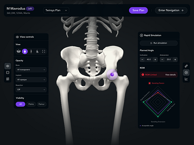 Advanced Surgical Planning with Real-Time 3D Visualization ai aiinhealthcare b2b ux dashboard design dashboard ux design digitalhealth enterprise enterprise ux healthcare healthcare app healthcare application healthcare design healthcare ux healthcareux healthtech healthtech ux ui uiux ux