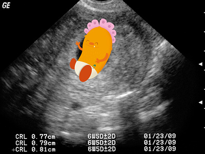 I'm having a baby! awesome baby excited goo goo monster ultrasound
