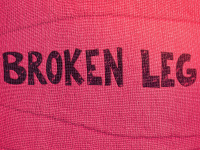 Broken Leg Title Style Frame animation broken leg cast style frame titles