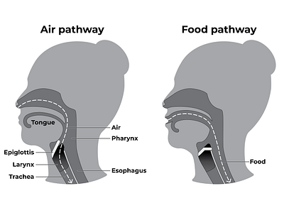 Epiglottis