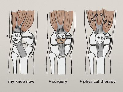 An illustrated conversation with a doctor anatomy illustration knee