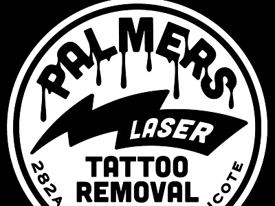 Palmers Laser Tattoo Removal laser palmers removal tattoo