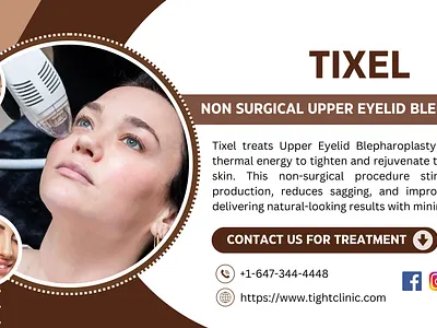 Rejuvenate Your Look with Upper Eyelid Blepharoplasty Toronto Us