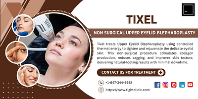 Rejuvenate Your Look with Upper Eyelid Blepharoplasty Toronto Us