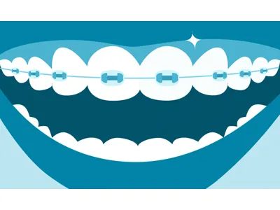 Illustration 25 dentist illustration teeth