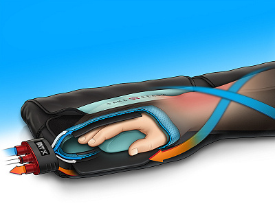 Cold Compression Wrap cutaway illustration technical illustration