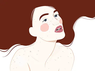 Freckles editorial face fashion flat vector freckles freelance illustration pale poster texture vector women