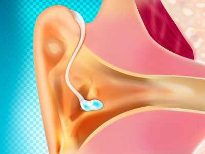 Hearing aid hearing aid illustration medical