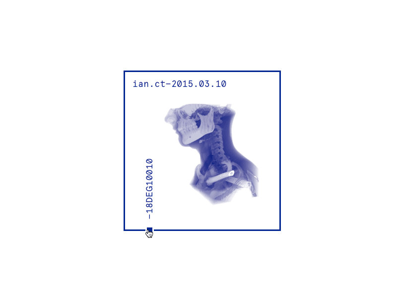 ian.ct- bone ct muscle slider xray