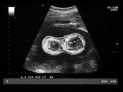 Book Review of Mr. Peanut editorial illustration marriage medical