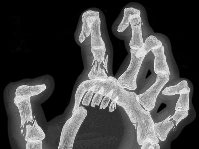 Screaming Hand X-Ray bones hand illustration pencil santa cruz screaming skateboard speed teeth x ray