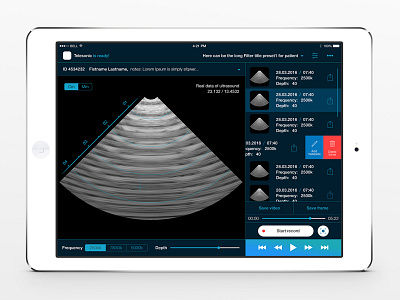 Telesonic app ios ipad ultrasound