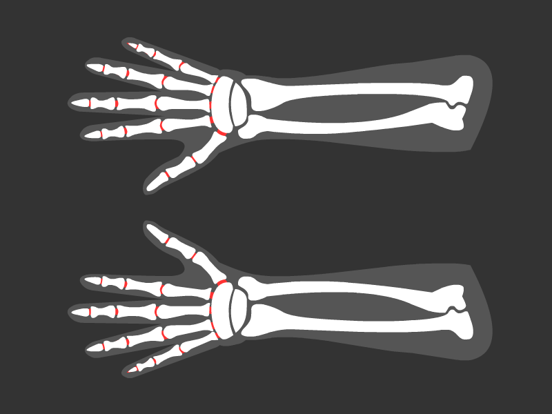 The Nimble Hands anatomy animation flat gif icon medical ui