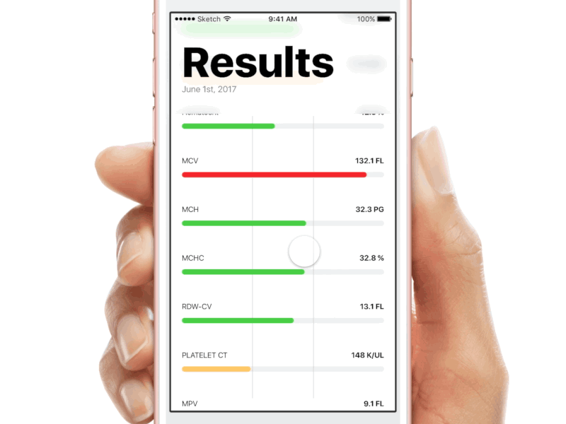 Blood Results bar framer framerjs prototype