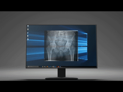 sending an x-ray after effects animation data display iphone monitor prototype screen send transfer wireframe