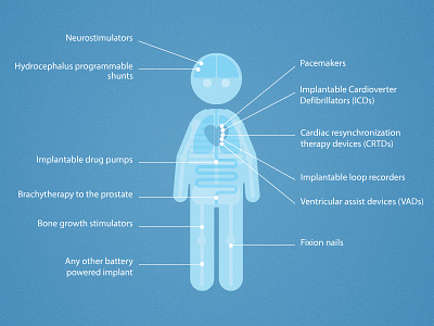 Medical implants cutaway medical surgery vector