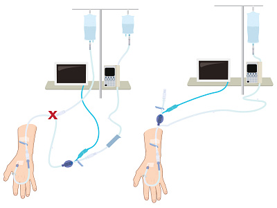 Volumetrix illustration medical illustration