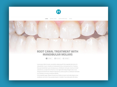 Casemasters Blog Post blog post casemasters components dental flat design gatsbyjs react social network ui ux