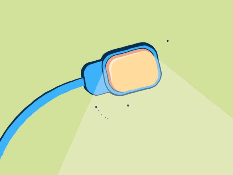 Electrical Problems animation curves design flicker fly glitch light loop motionstory