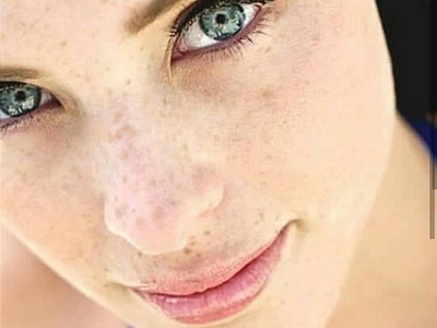 Before Skin Retouch editing freckles image editing photoshop retouch retouching