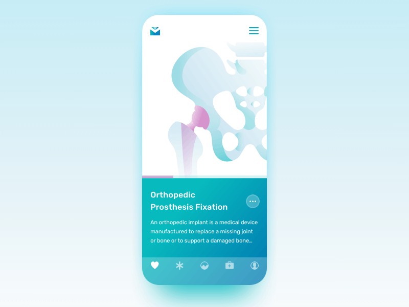 Medical Equipment App. Basic Screen Transition animation app animation app design equipment iphonex medical medical equipment principle prosthesis surgery transition user experience user inteface