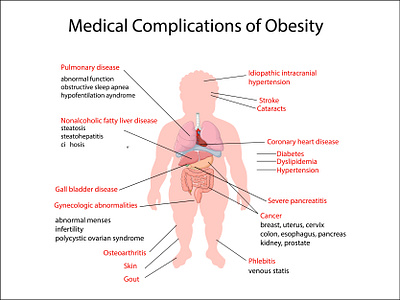 Anatomy of human body anatomical anatomy body cartoon complication fat human illustration infographic internal medical medicine obese obesity organ over overweight science system weight