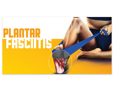 Plantar Fasciitis Digital Ad advertising anatomy design digital art digital illustration drawing illustration marketing typography