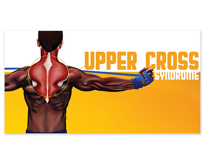 Upper Cross Syndrome Digital Ad advertising anatomy design digital art digital illustration drawing illustration marketing typography