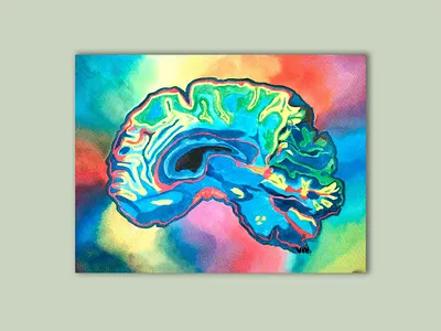 Brain Activity art brain design illustration neon psychedelic scan tie dye watercolor watercolor painting
