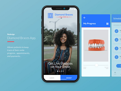 Diamond Braces Title Shot daily ui dental care dental clinic smile ui