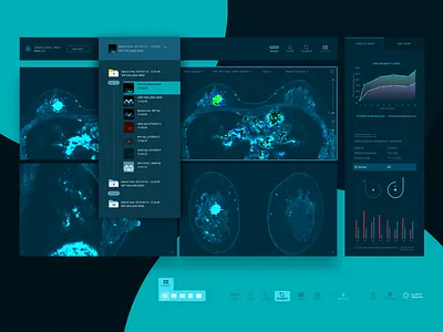 MRI Breast cancer AI analysis app UI design ai app application ct scan graph medical app mri navigation stats ui xray
