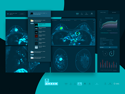 MRI Breast cancer AI analysis app UI design ai app application ct scan graph medical app mri navigation stats ui xray