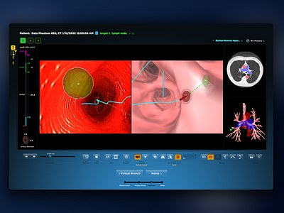 Bronchoscopic Surgical Navigation UI - Path Navigation app design desktop app desktop application desktop design medical medical app medical design ui ux