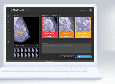 MammoScan: AI enabled mammogram toolkit ai app apple dark mode design flat healthcare healthcare app innovation interaction invision minimal ui ux web app