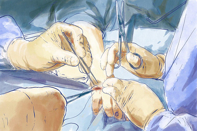 Surgery illustration medical procreate science