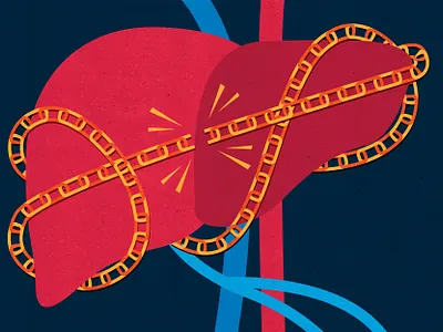 Breaking the Hepatitis C lifecycle anatomic anatomy conceptual disease editorial editorial art editorial illustration hc health hepatitis hepatitis c illustration illustrator liver textured treating virus