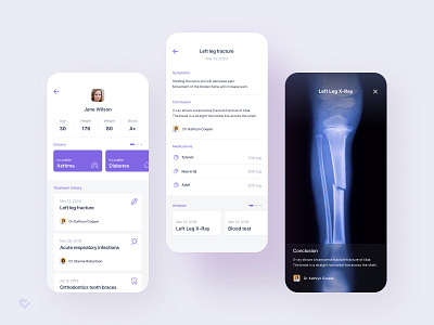 Medical App – Patient card app disease doctor figma fracture health illness medical medical app medical design medicine sickness treatment x ray