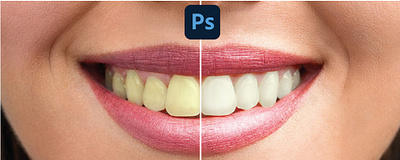 Teeth whitening graphic design photo