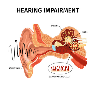 Hearing impairment anatomy anatomy ear illustration realistic tinnitus vector