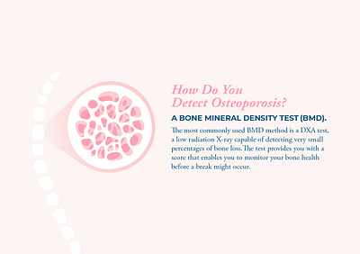 Osteoporosis Infographic Section body bone loss chart design female graphic graphic design health hospital illustration infographic medical medical illustration osteoporosis women x ray
