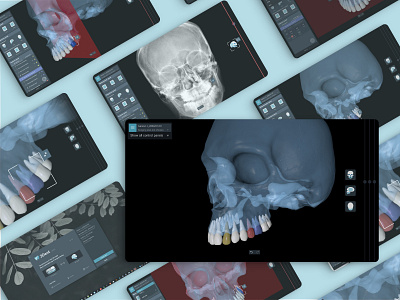 Dental surgery planning 3d ct ctscan dental desktop medical medical app medicine mri planer scull surgery