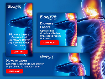 Banners for Diowave Laser adobe photoshop ads ads design banner ad banner design banners branding design photoshop web