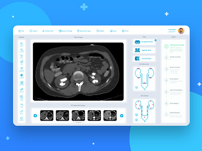 CT scan desktop app app appdesign branding design desktop app icon identity design illustration medical typogaphy typography ui user experience user interface ux web website