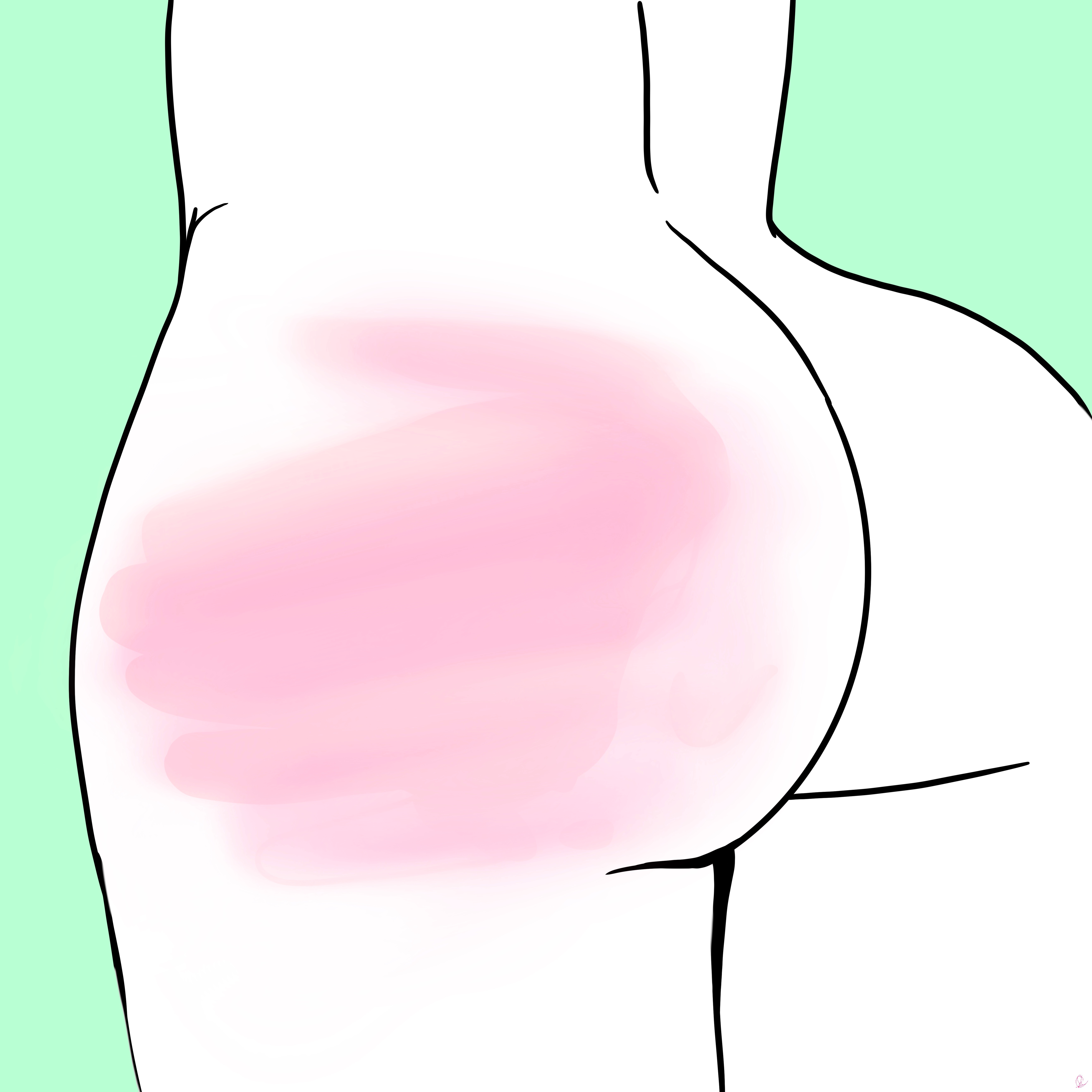 Example of Wilson