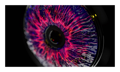 bloodshot cornea 3d