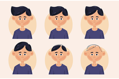 Hair Loss Stages Illustration age bald hair hairline head illustration loss male stages vector