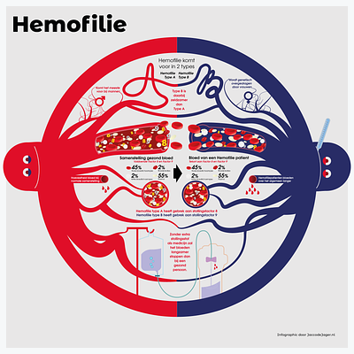 Infographic - Hemophilia data design disease hemofilie hemophilia illustratie illustration illustrator infographic nvhp umc utrecht visual data visual design visualise