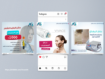 Social media post for dermatology clinic beauty branding derma design illustration laser logo post sales skin skincare social media design socialmedia ui vector